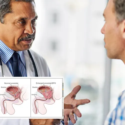 Comprehensive Care and Support for Penile Implant Patients