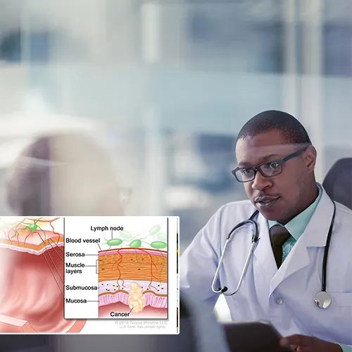 The Impact of Precision on Patient Outcomes