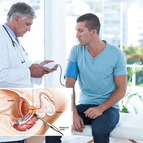 Welcome to the Comprehensive Guide on Daily Care for Penile Implants by High Pointe Surgery Center 
