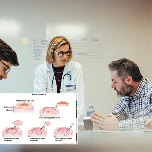 Exploring Malleable Penile Implants: Reliability Meets Simplicity