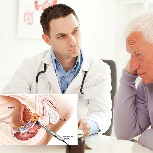 Penile Implants  An Introduction to the Transition